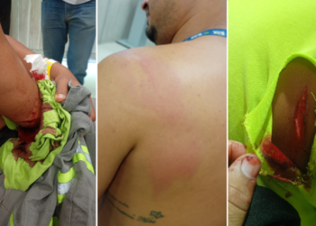 Funcionários da BRK são atacados com facão em Atalaia