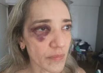 Passageira denuncia agressão de motociclista de app após desistir da corrida