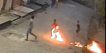 Mãe de menino ferido por fogos de artifício relata desespero