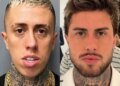 MC Daniel choca a web com antes e depois de procedimentos estéticos