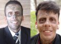 “Homem mais tatuado do Brasil” descobre tumor na bexiga